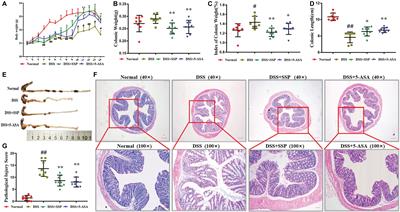 Regulatory Effect of Sishen Pill on Tfh Cells in Mice With Experimental Colitis